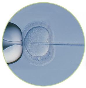 quien necesita de fertilización in vitro (FIV)